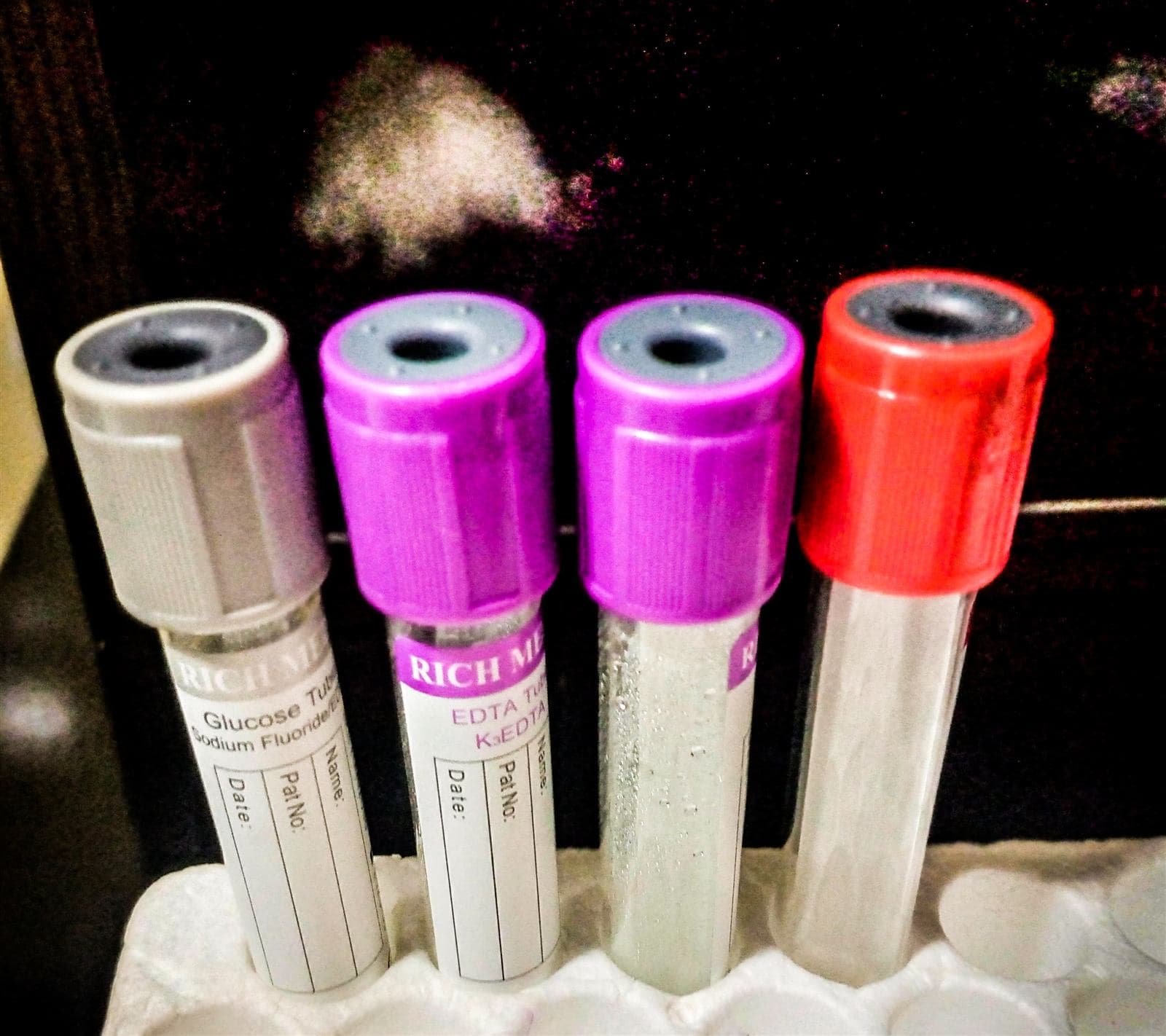 COVID-19 Antibody Tests Explained: What They Show and Don't Show
