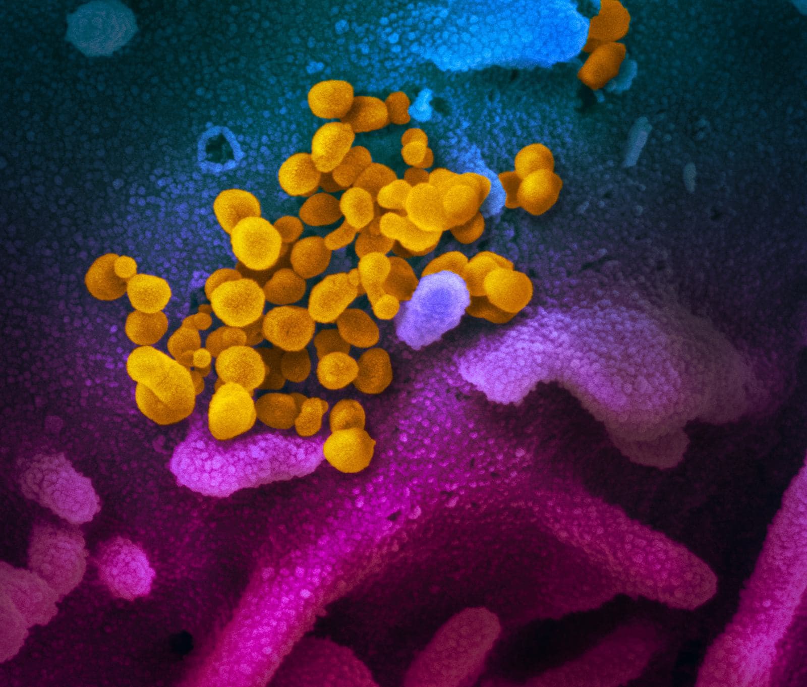 What is Coronavirus?